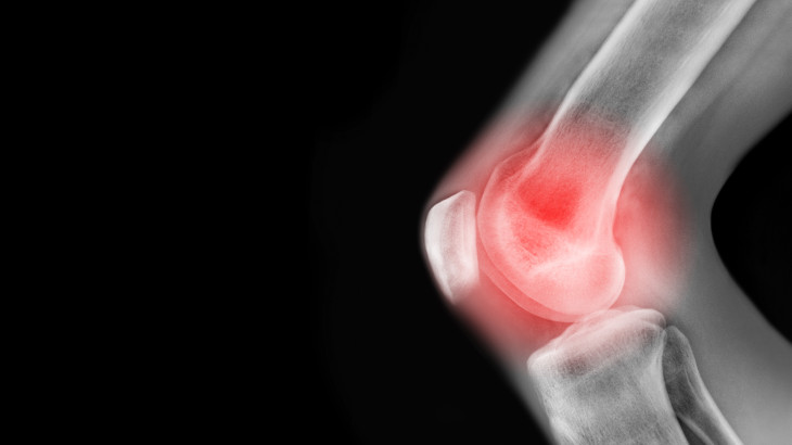 Fontos áttörés az orvostudományban: egy sor krónikus betegségre jöhet a terápia