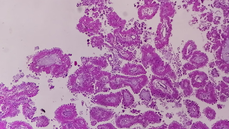 Évekig lapulhat az emberi agyban egy rejtélyes parazita: az orvosok is meglepődtek, mire képes