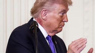 Kiderült az igazság Trump egészségéről – Túl szép, hogy igaz legyen, amit el akar hitetni a Fehér Ház?