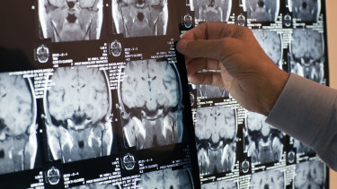 Lehengerlő tudományos kutatás az emberi agyról: sokkal tovább tart a kulcsfontosságú életszakasz, mint azt gondoltuk