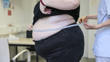 Az orvostudomány kezelni tudja az elhízást, abban viszont nem tud megegyezni, mi is az valójában